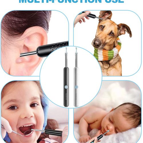 Прибор для чистки ушей Xiaomi Bebird Smart Visual Spoon Ear Stick R1